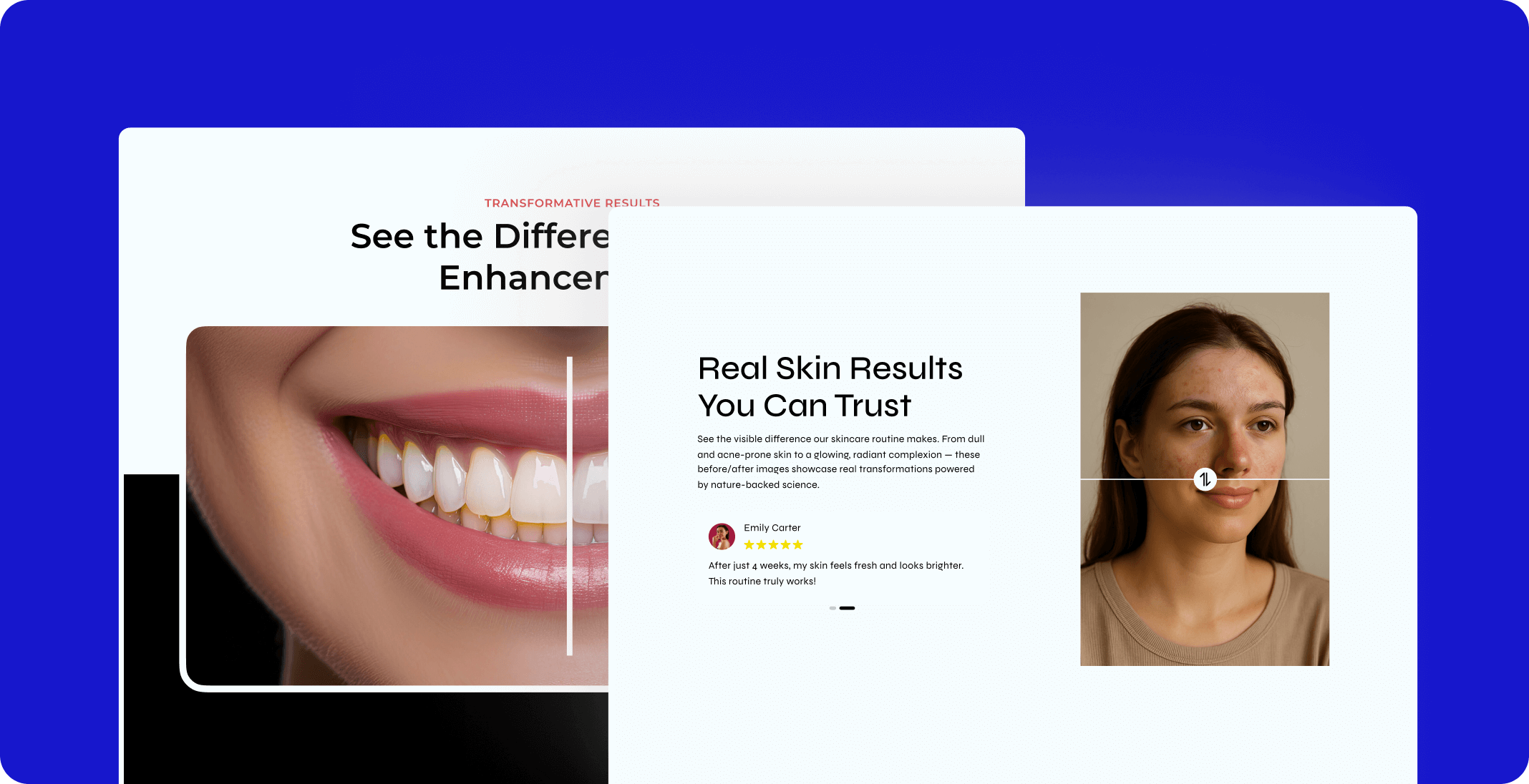 before after show off 1