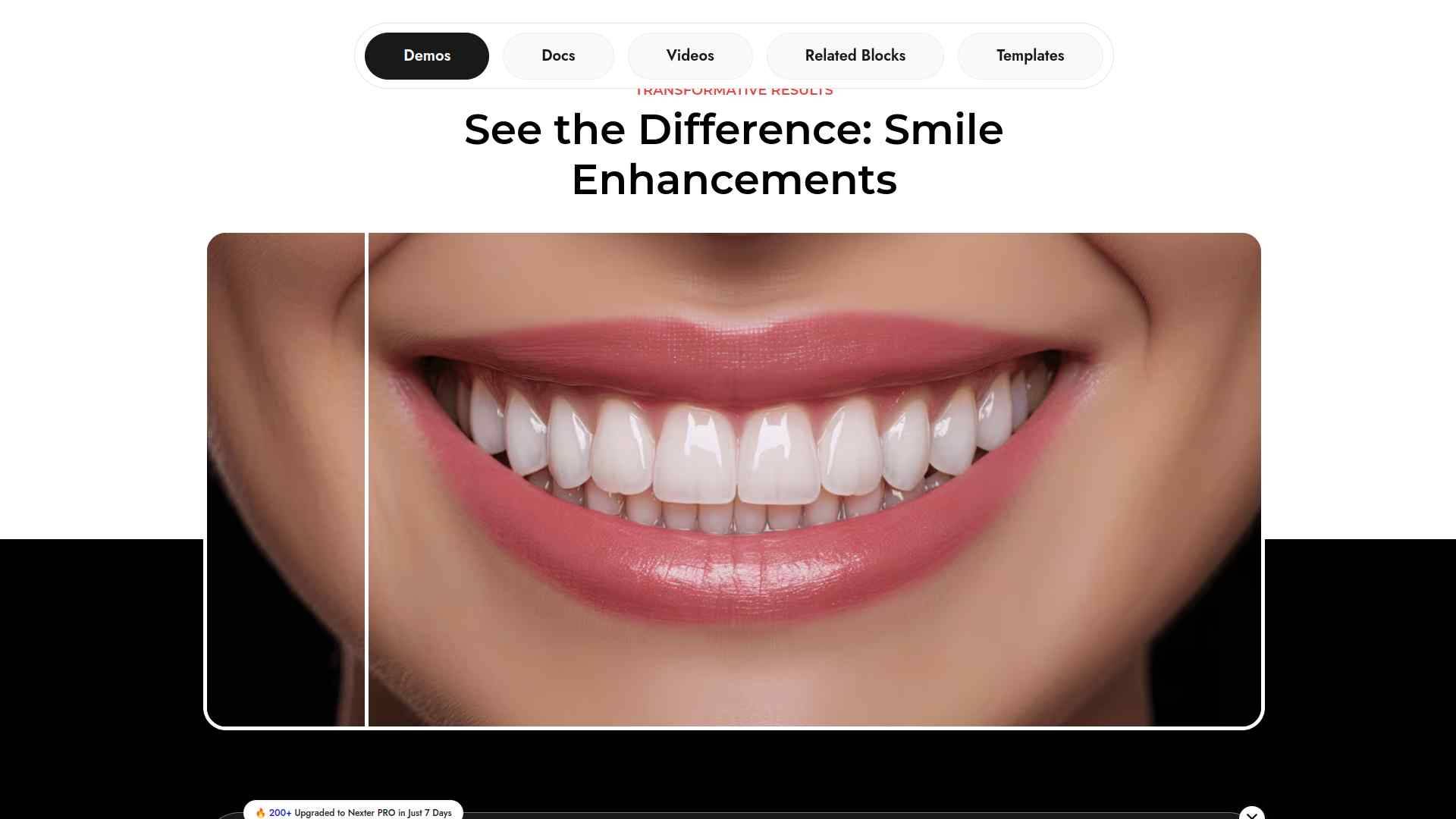 Nexter Before After block demo showing interactive image comparison slider on a live WordPress page